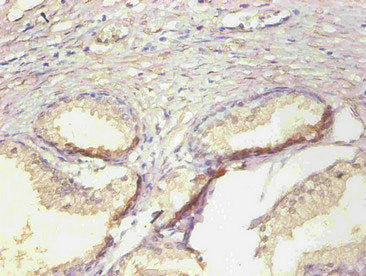 LCN2 Monoclonal Antibody