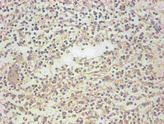 LCN2 Monoclonal Antibody