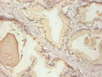 LCN2 Monoclonal Antibody