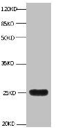 LCN2 Monoclonal Antibody