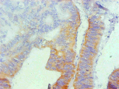 SPP1 Monoclonal Antibody