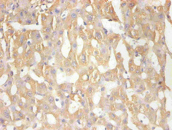 RBP4 Monoclonal Antibody
