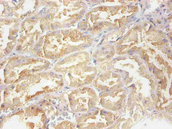 RBP4 Monoclonal Antibody