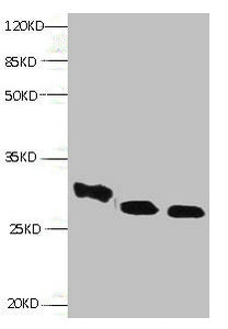 RBP4 Monoclonal Antibody