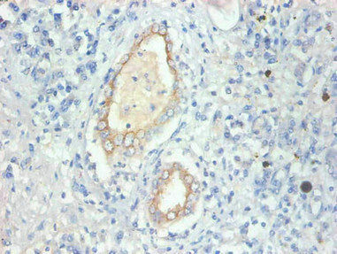 FABP3 Monoclonal Antibody