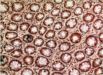 TUBG1 Monoclonal Antibody