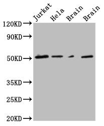 TUBG1 Monoclonal Antibody
