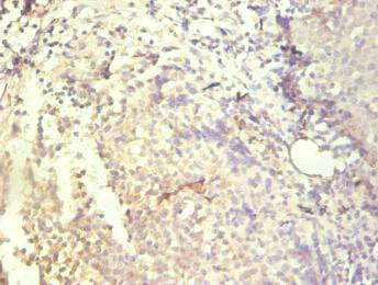 CXCL8 Monoclonal Antibody