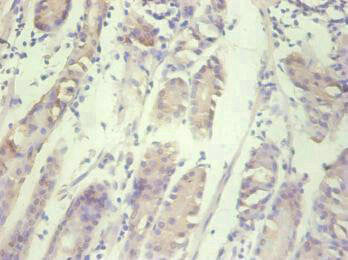 CXCL8 Monoclonal Antibody