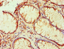 PLA2G7 Monoclonal Antibody