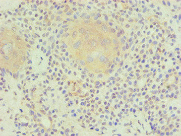 PLA2G7 Monoclonal Antibody
