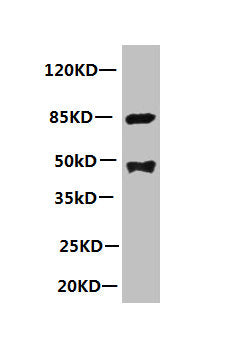 PLA2G7 Monoclonal Antibody