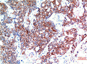 BECN1 Monoclonal Antibody