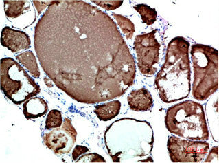 TTR Monoclonal Antibody