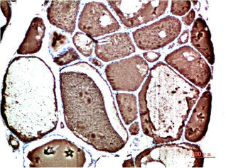 TTR Monoclonal Antibody