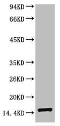 TTR Monoclonal Antibody