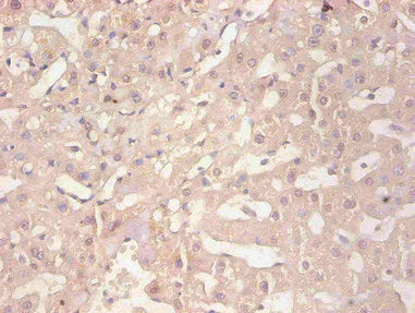 FTL Monoclonal Antibody