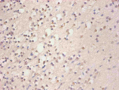 FTL Monoclonal Antibody