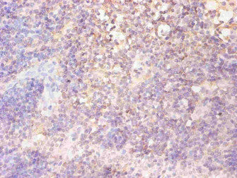 FTL Monoclonal Antibody