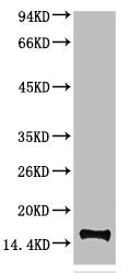 TTR Monoclonal Antibody