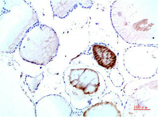 TTR Monoclonal Antibody