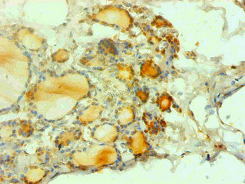CALCA Monoclonal Antibody