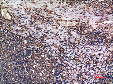 CCNB1 Monoclonal Antibody
