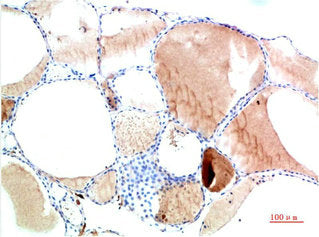 TTR Monoclonal Antibody