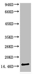 TTR Monoclonal Antibody