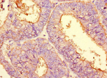 PODXL Monoclonal Antibody