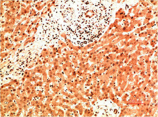 COL4A1 Monoclonal Antibody