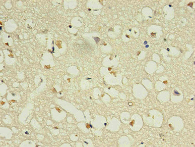NPPB Monoclonal Antibody