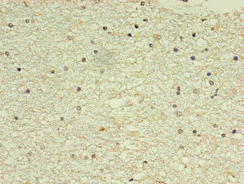 NPPB Monoclonal Antibody