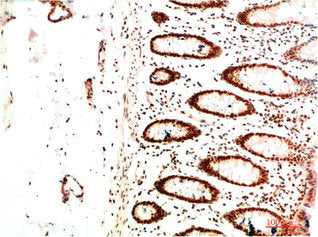 CBX5 Monoclonal Antibody