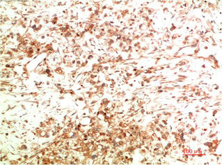 ATG5 Monoclonal Antibody