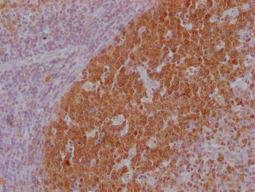 POU2AF1 Monoclonal Antibody