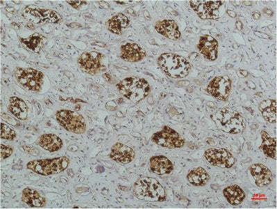 NFKBIB Monoclonal Antibody