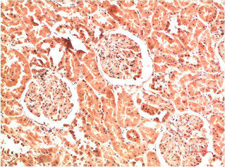 COL4A1 Monoclonal Antibody