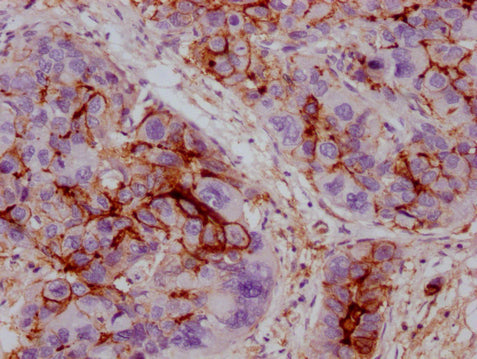 ICAM1 Monoclonal Antibody