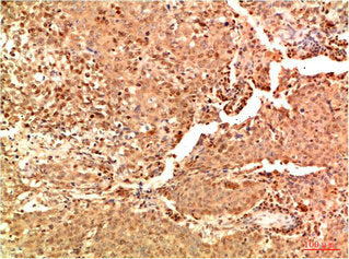 Acetyl-RELA(K314/K315) Monoclonal Antibody