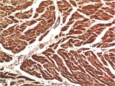CDH5 Monoclonal Antibody