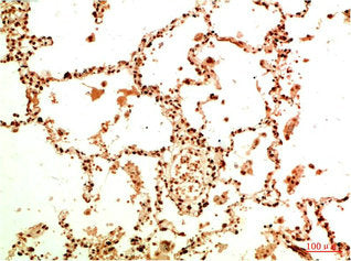 Acetyl-RELA(K314/K315) Monoclonal Antibody