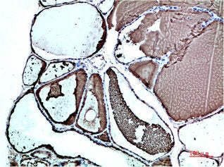 TTR Monoclonal Antibody
