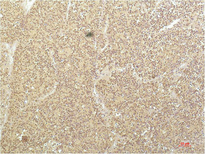 SGK1 Monoclonal Antibody