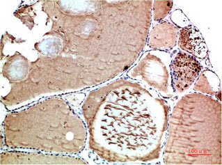 TTR Monoclonal Antibody