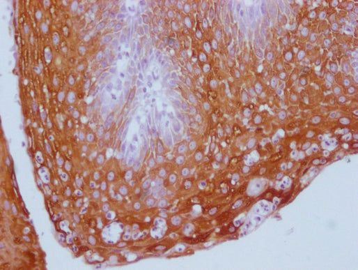 KRT13 Monoclonal Antibody