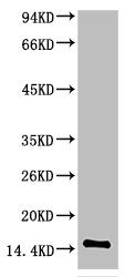 TTR Monoclonal Antibody
