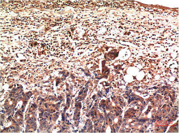 Ubiquitin Monoclonal Antibody