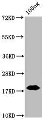 Nucleoprotein (NTD)  Antibody