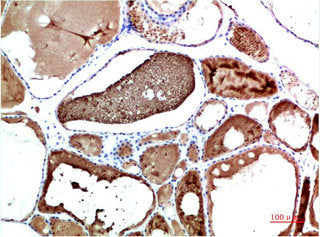 TTR Monoclonal Antibody